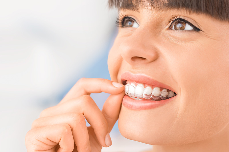 Invisalign in South San Francisco